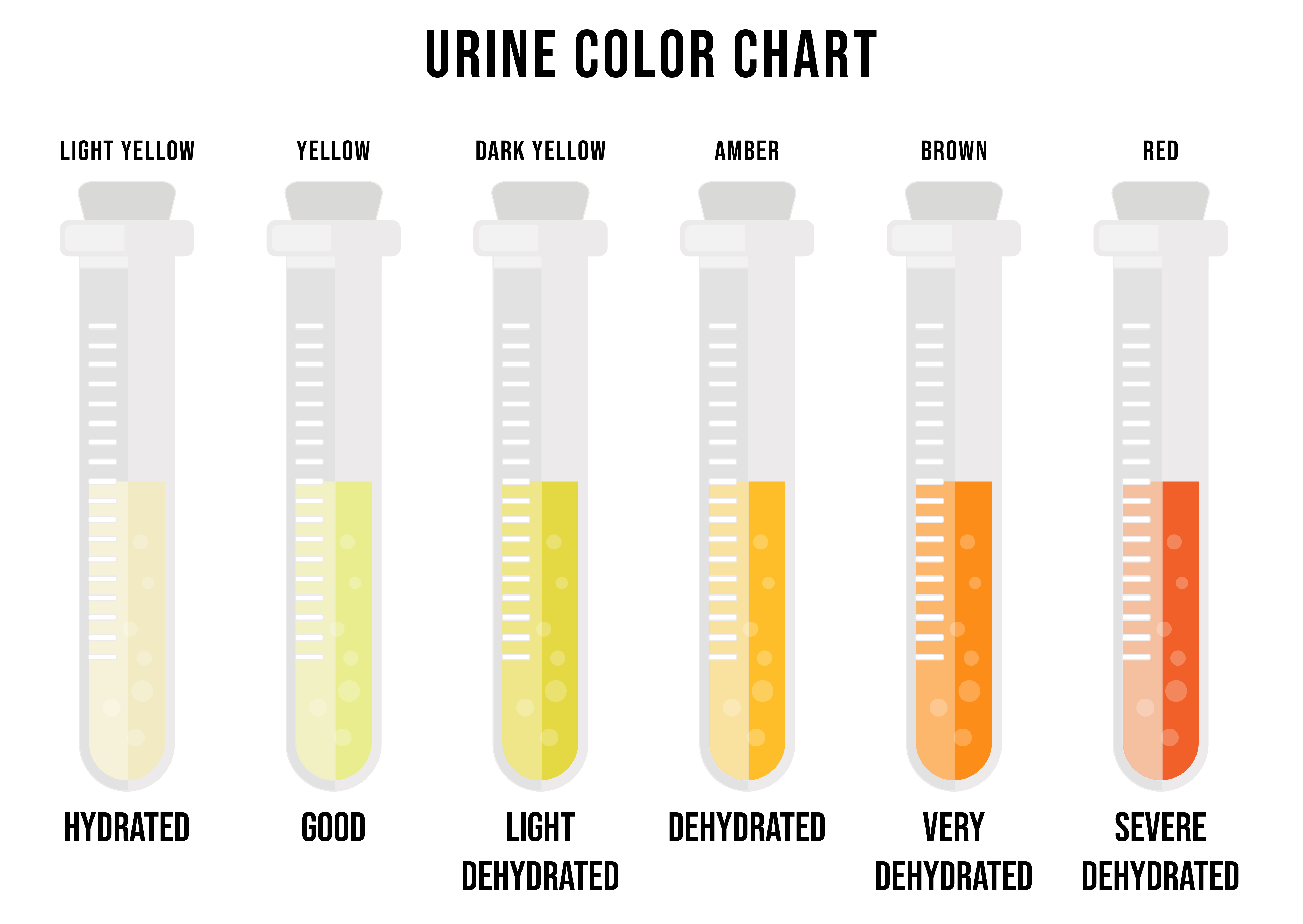 Urine_Colour_Chart